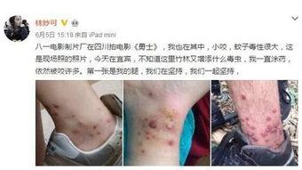 毒虫图片,惊悚瞬间捕捉毒虫真实面貌